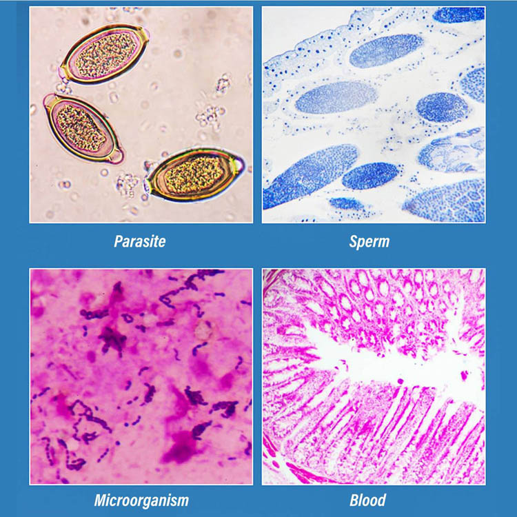 Mikroskop cyfrowy USB 5MP z 8  – Usb Microscope 1000X Digital recenzja i cena